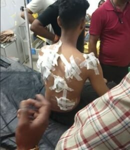 लखनऊ में BTech छात्र पर चाकू से हमला